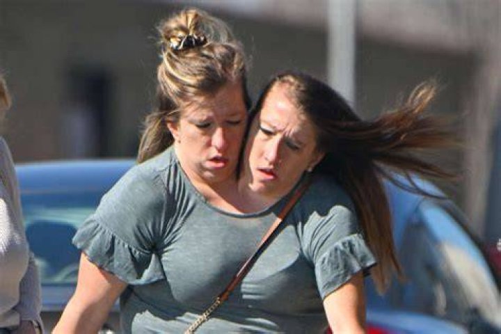 Abby and Brittany Hensel Baby: The Extraordinary Journey of Life's Miracles