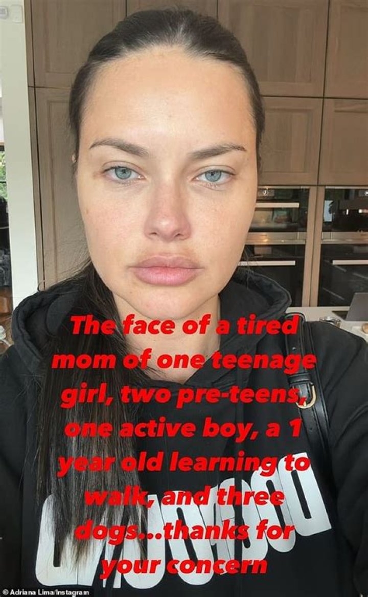 Adriana Lima's Top Falling Off: The Drama, The Truth, and The Legacy