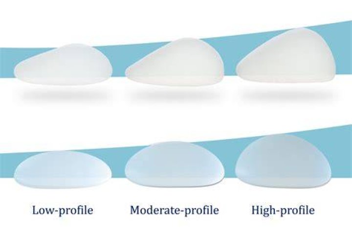 Bianca Censori Breast Implants: The Journey, Impact, and Expert Insights