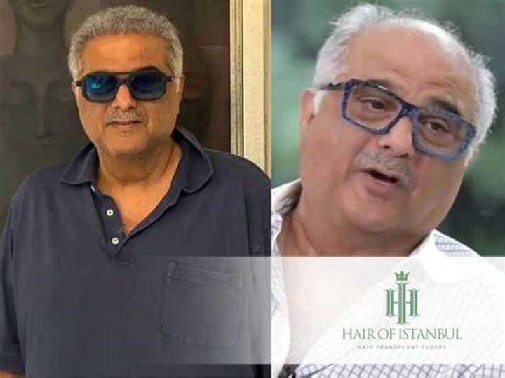 Boney Kapoor Hair: A Comprehensive Guide to Style, Care, and Expert Tips