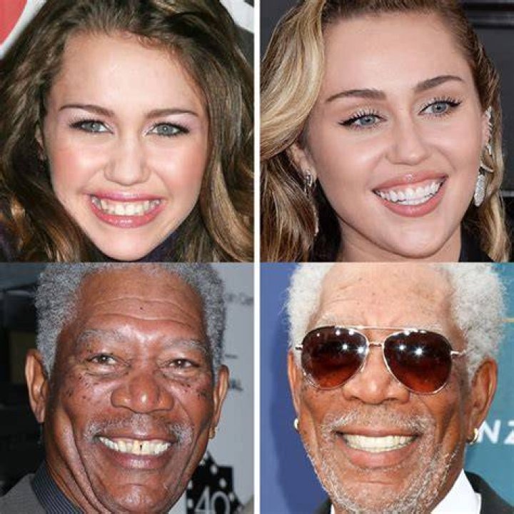 Gap Teeth & Confidence: [Celebrities Embracing Their Smiles]