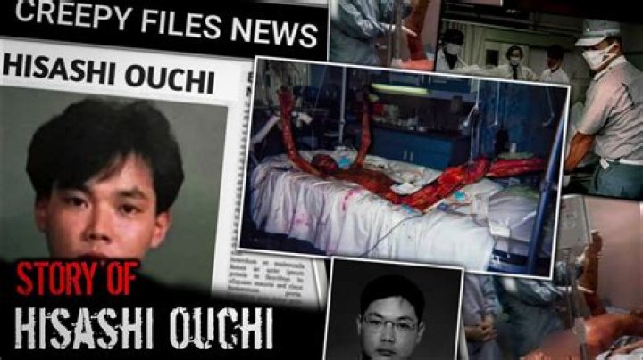 Hisashi Ouchi Fotos Reales: Unveiling the Truth Behind the Tragic Story