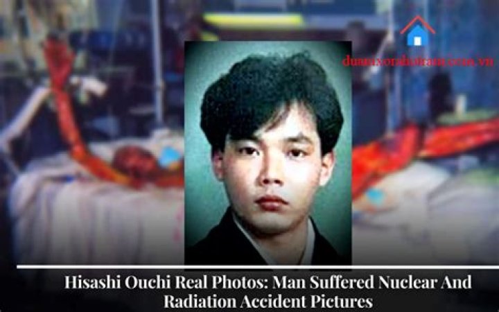 Hisashi Ouchi Real Photo: The Untold Story Behind the Iconic Image