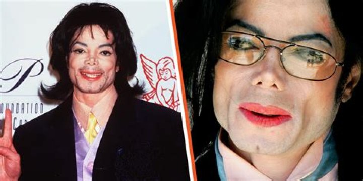 How Was Michael Jackson White: Exploring the Truth Behind His Skin Transformation