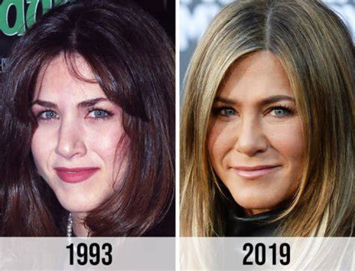 Jennifer Aniston Nose Job Before and After: The Truth Behind the Transformation