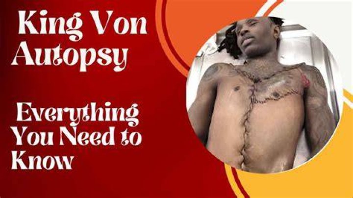 King Von Autopsy: A Detailed Insight into the Life and Legacy of a Rising Star