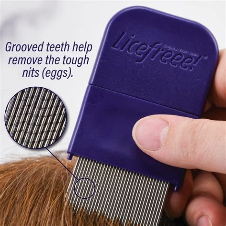 Protex Bond Ex: The Ultimate Solution for Hair Lice and Nits