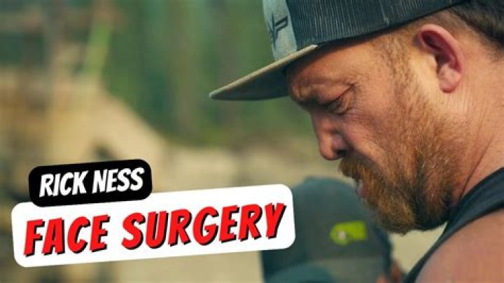 What Happened to Rick Ness Face: Unveiling the Truth Behind the Transformation