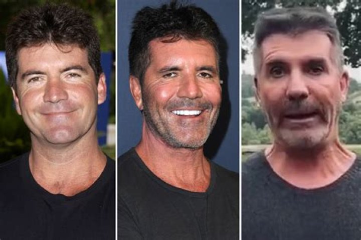 What Happened to Simon Cowell: A Comprehensive Look at His Journey, Health, and Career