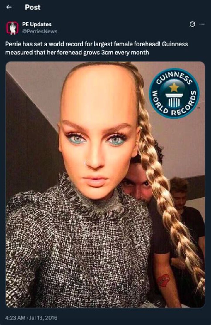 Who Has the Biggest Forehead in the World? Exploring the Fascinating Facts