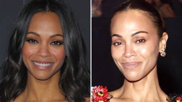 Zoe Saldana Plastic Surgery: The Truth Behind the Rumors